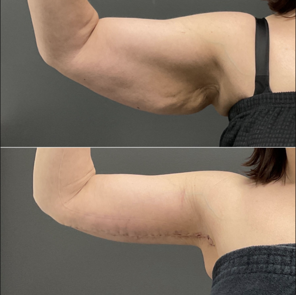 Why Awake Surgery Might Be the Safest and Smartest Option